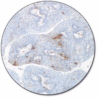 PD-L1 IHC 28-8 pharmDx for Autostainer Link 48